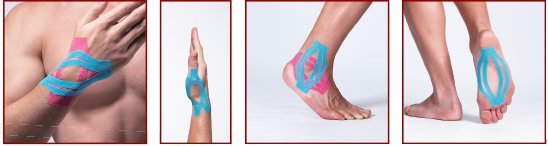 kinesiology taping taping